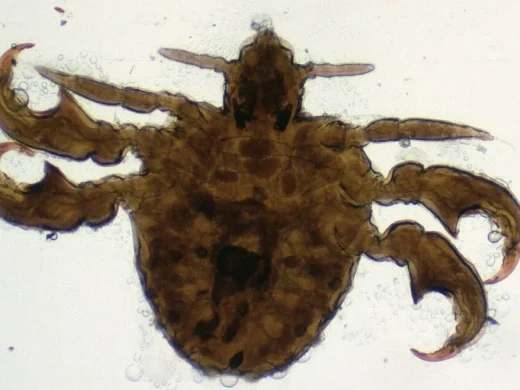 Stark vergrößerte Mikroskopaufnahme einer Filzlaus von oben; der breite, gedrungene Körper trägt kräftige krallenbewehrte Beine, die an eine Krabbe erinnern.