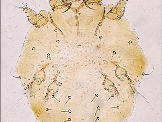 Lichtmikroskopische Aufnahme einer Krätzmilbe von oben mit rundlichem Körper, kurzen Beinen und borstenbesetztem Rücken.
