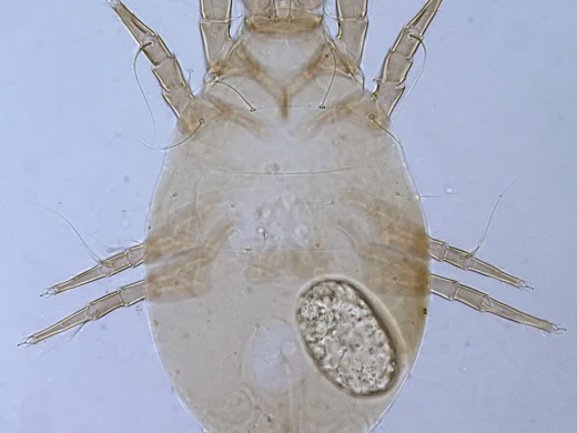 Mikroskopaufnahme einer weiblichen Mehlmilbe (Acarus siro) von oben: durchscheinender ovaler Körper mit acht Beinen, langen Borsten und einem sichtbaren Ei im Inneren.