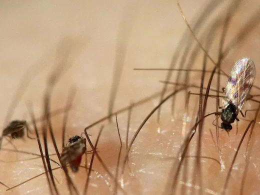 Mehrere winzige Gnitzen mit schillernden Flügeln sitzen saugend zwischen den feinen Härchen menschlicher Haut.